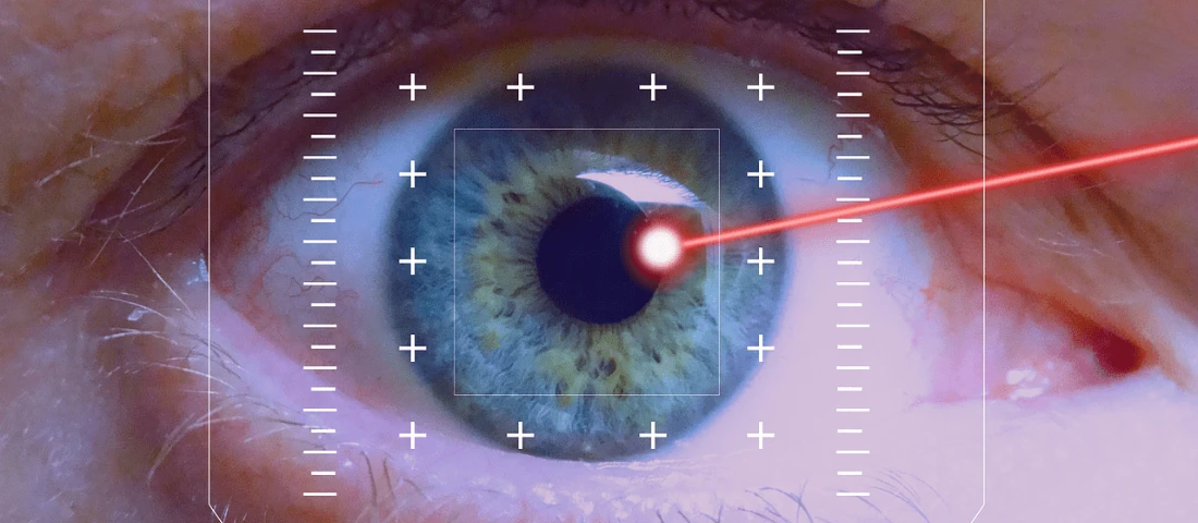 Вторичная катаракта: почему появляется и как лечить?