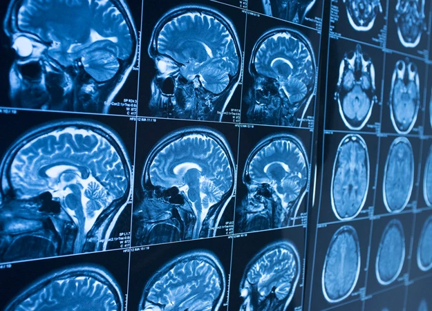 Почему комплексные МРТ-исследования лучше?